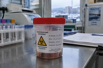 Peste in Siberia: 3 scenari possibili di diffusione fuori dalla Russia se fosse un virus uscito da un laboratorio