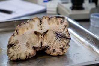 Il cervello elimina ci� che non serve: il pruning sul lavoro e nella vita di tutti i giorni