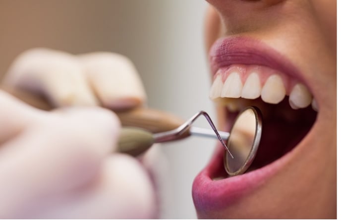 Come curare i denti se non si hanno soldi o non sono sufficienti per interventi 
