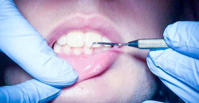 Come fare a diventare dentista? Diploma, laurea, corsi e certificazioni