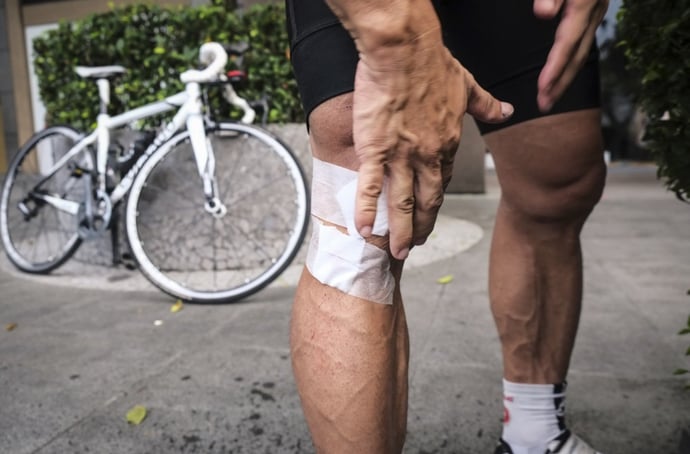 Cosa succede se investo un ciclista con l'auto in base al Codice della Strad